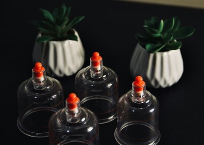 cupping therapy